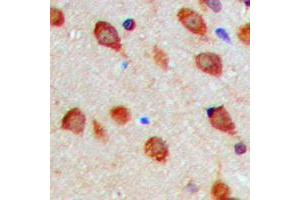 Immunohistochemical analysis of Aurora A (pT288) staining in human brain formalin fixed paraffin embedded tissue section.
