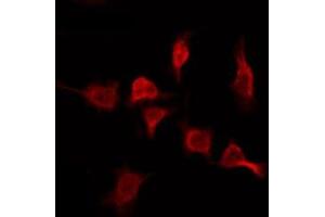 ABIN6276078 staining MCF7 by IF/ICC. (OR2T11 anticorps  (Internal Region))