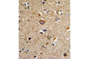 Formalin-fixed and paraffin-embedded human brain tissue with CD81 Antibody (C-term), which was peroxidase-conjugated to the secondary antibody, followed by DAB staining. (CD81 anticorps  (C-Term))