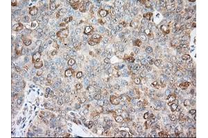 Immunohistochemical staining of paraffin-embedded Human liver tissue using anti-BCL10 mouse monoclonal antibody. (BCL10 anticorps)