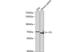 Western blot analysis of extracts of various cell lines using CEL Polyclonal Antibody at dilution of 1:500. (Cholesterol Esterase anticorps)