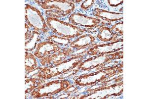 Immunohistochemistry of paraffin-embedded mouse kidney using NDUFB8 Rabbit mAb (ABIN7268813) at dilution of 1:100 (40x lens).