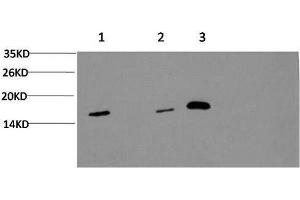 Western Blot analysis of 1) Hela, 2) 3T3, 3) Rat brain using MAP1LC3A Monoclonal Antibody at dilution of 1:1000.