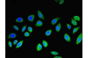 Immunofluorescent analysis of A549 cells using ABIN7159245 at dilution of 1:100 and Alexa Fluor 488-congugated AffiniPure Goat Anti-Rabbit IgG(H+L)