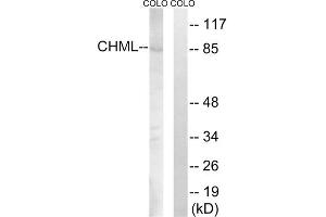 Western blot analysis of extracts from COLO cells, using CHML antibody. (CHML anticorps  (Internal Region))