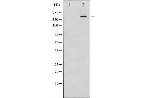 Western blot analysis of IRS-1 phosphorylation expression in K562 whole cell lysates,The lane on the left is treated with the antigen-specific peptide. (IRS1 anticorps  (pSer307))
