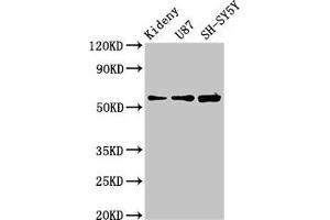 Western Blot Positive WB detected in: Mouse kidney tissue, U87 whole cell lysate, SH-SY5Y whole cell lysate All lanes: KCNAB1 antibody at 3. (KCNAB1 anticorps  (AA 287-401))
