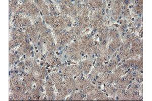 Image no. 4 for anti-Tryptophan 2,3-Dioxygenase (TDO2) antibody (ABIN1501352)