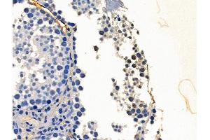 PHF8 Antibody at 1/100 staining Mouse testis tissue by IHC-P. (PHF8 anticorps  (C-Term))