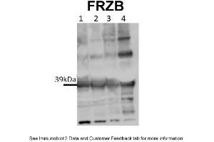 WB Suggested Anti-FRZB Antibody Titration: 0. (FRZB anticorps  (Middle Region))