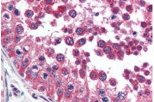 Human Testis (formalin-fixed, paraffin-embedded) stained with HAVCR1 antibody ABIN292372 at 2. (HAVCR1 anticorps  (AA 200-300))