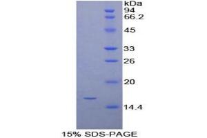 SDS-PAGE analysis of Mouse Synuclein gamma Protein. (SNCG Protéine)