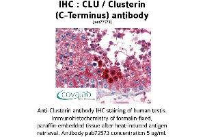 Image no. 1 for anti-Clusterin (CLU) (C-Term) antibody (ABIN1733163) (Clusterin anticorps  (C-Term))