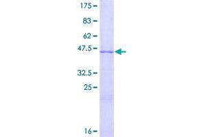 Image no. 1 for Glial Cell Line Derived Neurotrophic Factor (GDNF) (AA 1-211) protein (GST tag) (ABIN1354985)