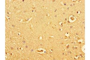 Immunohistochemistry of paraffin-embedded human brain tissue using ABIN7154928 at dilution of 1:100