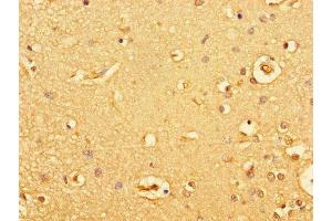 Immunohistochemistry of paraffin-embedded human brain tissue using ABIN7154928 at dilution of 1:100 (GUCY2C anticorps  (AA 636-891))
