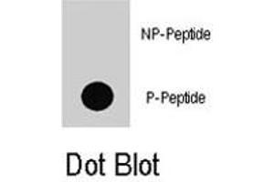Dot blot analysis of BRAF (phospho T598) polyclonal antibody  on nitrocellulose membrane. (BRAF anticorps  (pThr598))