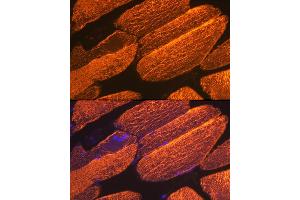 Immunofluorescence analysis of mouse skeletal muscle using α-Actin-1  Rabbit mAb (ABIN3015986, ABIN3015987, ABIN1680683 and ABIN1680684) at dilution of 1:100 (40x lens). (Actin anticorps)