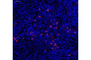 Immunofluorescence of paraffin embedded human subcutaneous transplant tumor K562 using c-caspase3 (ABIN7073336) at dilution of 1:1200 (200x lens)