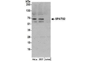 anti-Spermatogenesis Associated, Serine-Rich 2 (SPATS2) (AA 450-500) antibody