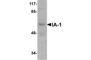 Western blot analysis of IA-1 in rat thymus tissue lysate with AP30396PU-N IA-1 antibody at 1 μg/ml.
