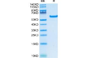 Human CD40 on Tris-Bis PAGE under reduced condition. (CD40 Protein (CD40) (AA 21-193) (Fc Tag))