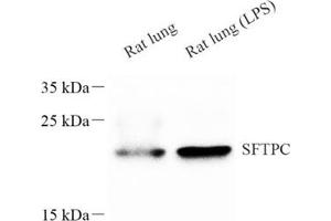 Western blot analysis of sftpc (ABIN7075216),at dilution of 1: 600 (Prosurfactant Protein C anticorps)