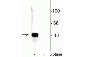 Western blot of human T47D cell lysate showing specific immunolabeling of ~42-44 kDa ERK/MAPK protein phosphorylated at Thr202/Tyr204 in the first lane (-). (MAPK1/2 (pThr202), (pTyr204) anticorps)