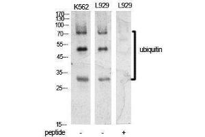 Western Blotting (WB) image for anti-Ubiquitin (Ubiquitin) (Internal Region) antibody (ABIN3181396) (Ubiquitin anticorps  (Internal Region))