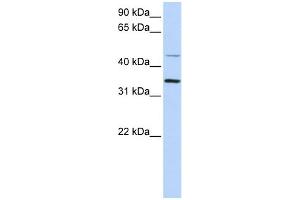 anti-Ceroid-Lipofuscinosis, Neuronal 6, Late Infantile, Variant (CLN6) (C-Term) antibody