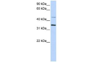 WB Suggested Anti-CLN6 Antibody Titration:  0. (CLN6 anticorps  (C-Term))