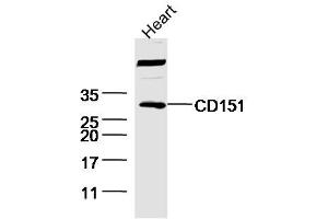 CD151 anticorps  (AA 101-200)