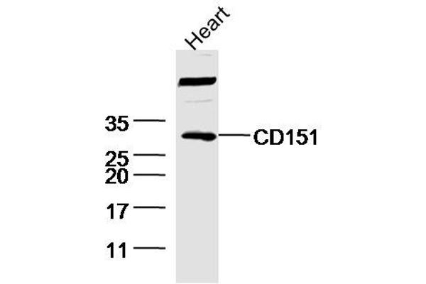 CD151 anticorps  (AA 101-200)