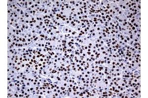 Image no. 5 for anti-Nibrin (NBN) (AA 183-460) antibody (ABIN1491059)