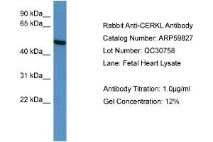 WB Suggested Anti-CERKL  Antibody Titration: 0. (CERKL anticorps  (C-Term))
