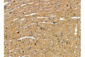 ABIN7095381 and ABIN7099438 at 1/100 staining rat heart tissue by IHC-P. (Endogenous retrovirus group 3 member 1 Env polyprotein (ERV3-1) anticorps)