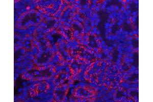 anti-Transthyretin (TTR) (AA 21-147) antibody
