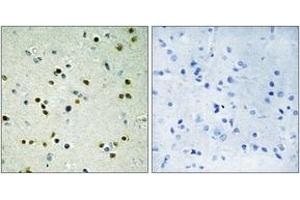 Immunohistochemistry analysis of paraffin-embedded human brain, using JHD3B Antibody. (JHD3B anticorps  (AA 351-400))