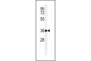 Western blot analysis of R6G Antibody (N-term) (ABIN650946 and ABIN2840004) in ZR-75-1 cell line lysates (35 μg/lane). (PARD6G anticorps  (N-Term))