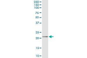 anti-Mediator Complex Subunit 18 (MED18) (AA 1-208) antibody