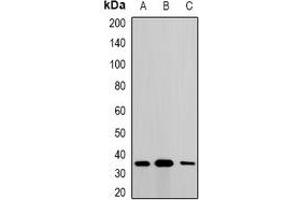 Western blot analysis of Metaxin-1 expression in A549 (A), SKOV3 (B), mouse liver (C) whole cell lysates. (Metaxin 1 anticorps)