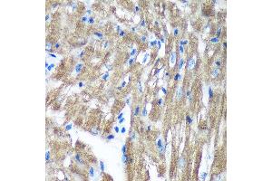 Immunohistochemistry of paraffin-embedded Mouse heart using TIMMDC1 Rabbit pAb (ABIN7270929) at dilution of 1:100 (40x lens). (TIMMDC1 anticorps  (AA 206-285))
