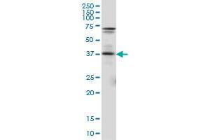 PAX5 monoclonal antibody (M01), clone 8F9. (PAX5 anticorps  (AA 192-301))