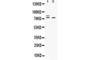 Western blot analysis of Plzf expression in rat ovary extract ( Lane 1) and SKOV3 whole cell lysates ( Lane 2). (ZBTB16 anticorps  (AA 1-165))