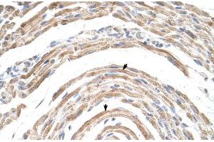 Immunohistochemical staining (Formalin-fixed paraffin-embedded sections) of human muscle with CPSF6 polyclonal antibody . (CPSF6 anticorps  (AA 261-310))