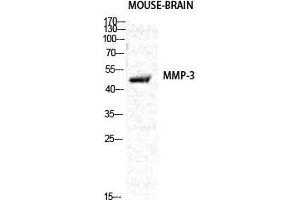 Western Blot (WB) analysis of specific cells using MMP-3 Polyclonal Antibody.