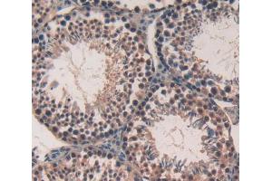 Used in DAB staining on fromalin fixed paraffin- embedded Kidney tissue (CABIN1 anticorps  (AA 11-289))