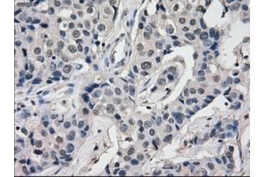 Image no. 3 for anti-Budding Uninhibited By Benzimidazoles 1 Homolog beta (Yeast) (BUB1B) antibody (ABIN1496995) (BUB1B anticorps)