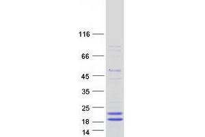 Validation with Western Blot