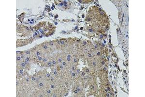 Immunohistochemistry of paraffin-embedded Human stomach using UBE2S Polyclonal Antibody at dilution of 1:100 (40x lens). (UBE2S anticorps)